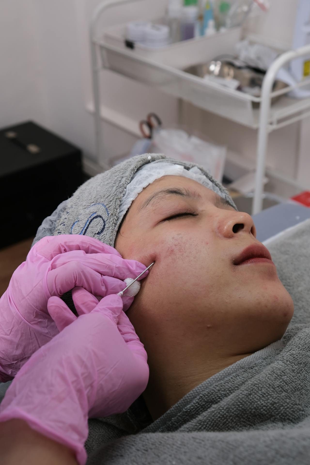 Rejuvenecimiento facial (Dermapen)