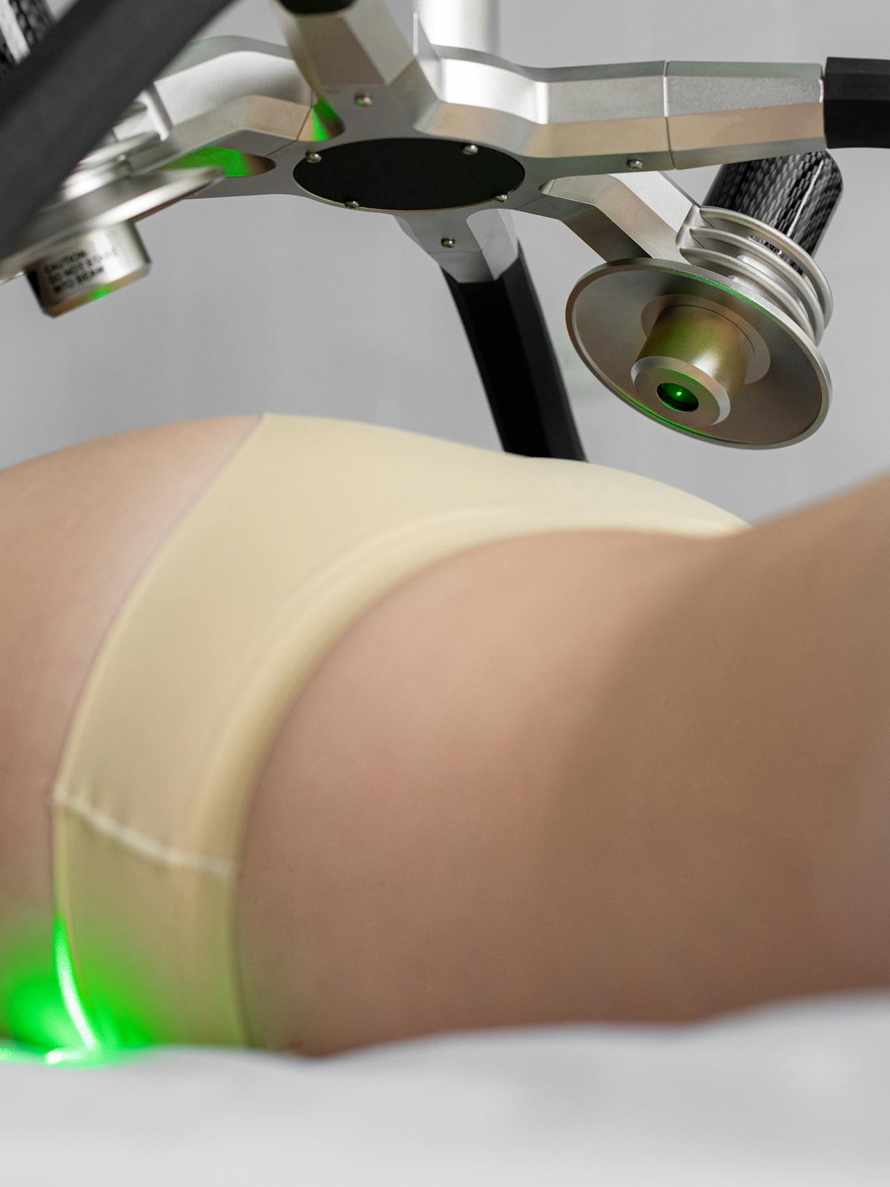 MiniLipo (Lipo sin cirugia) cuerpo completo