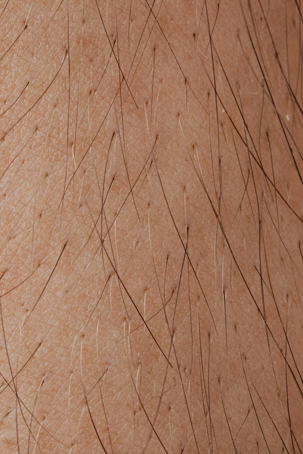 Terapia Capilar - Crecida de Cabello