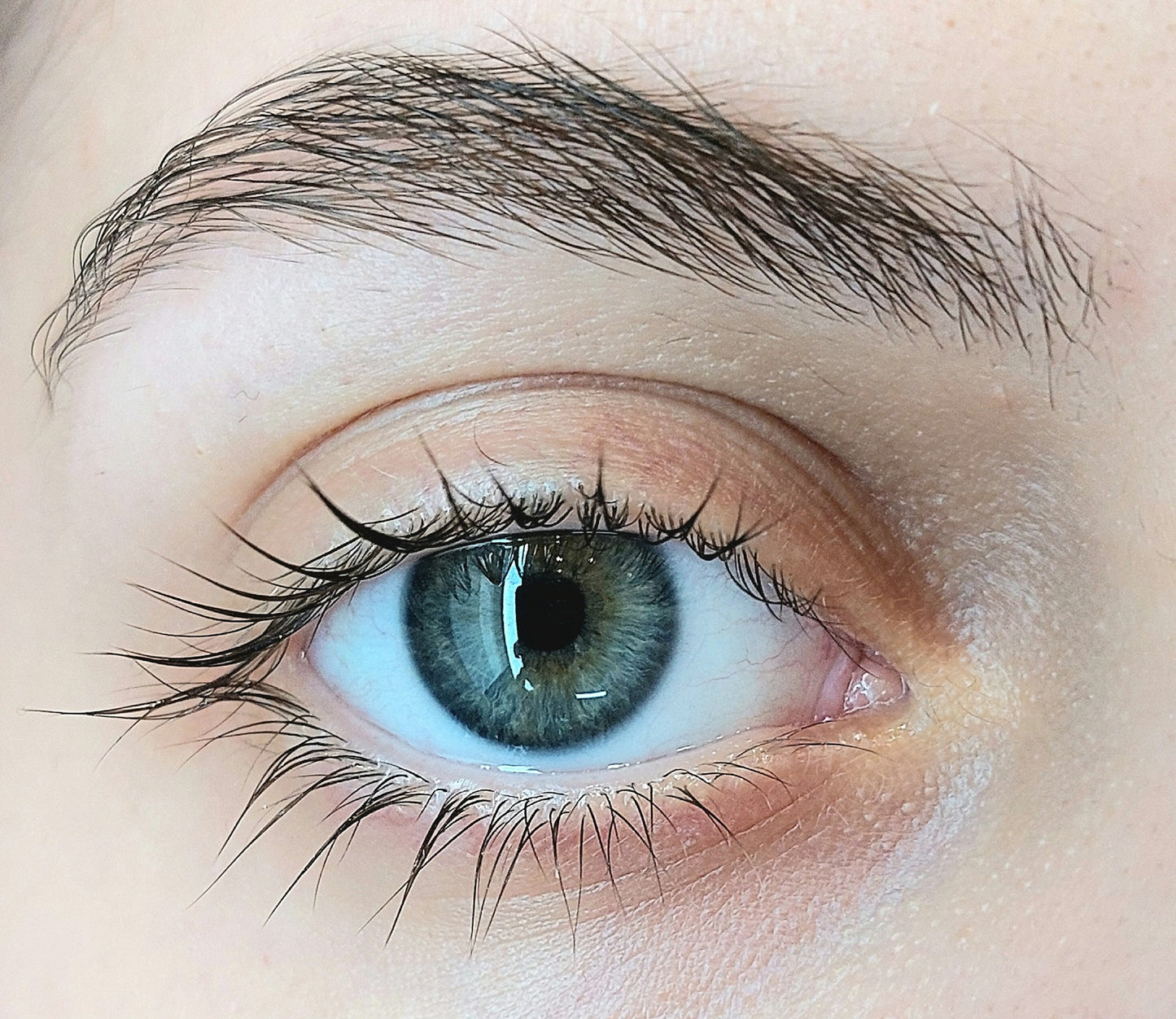 Fibroblast (Levantamiento de Mirada)